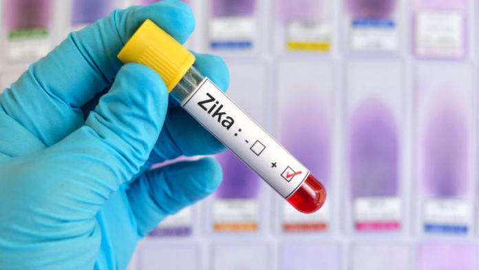 Virus Zika và những điều cần biết về virus Zika khi mang thai